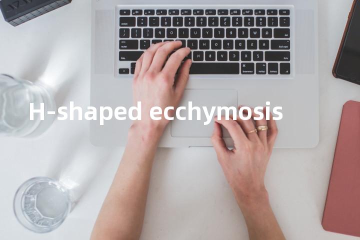 H-shaped ecchymosis单词图解，单词释义场景配图